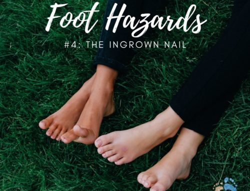 Summer Foot Hazards #4: The ingrown nail