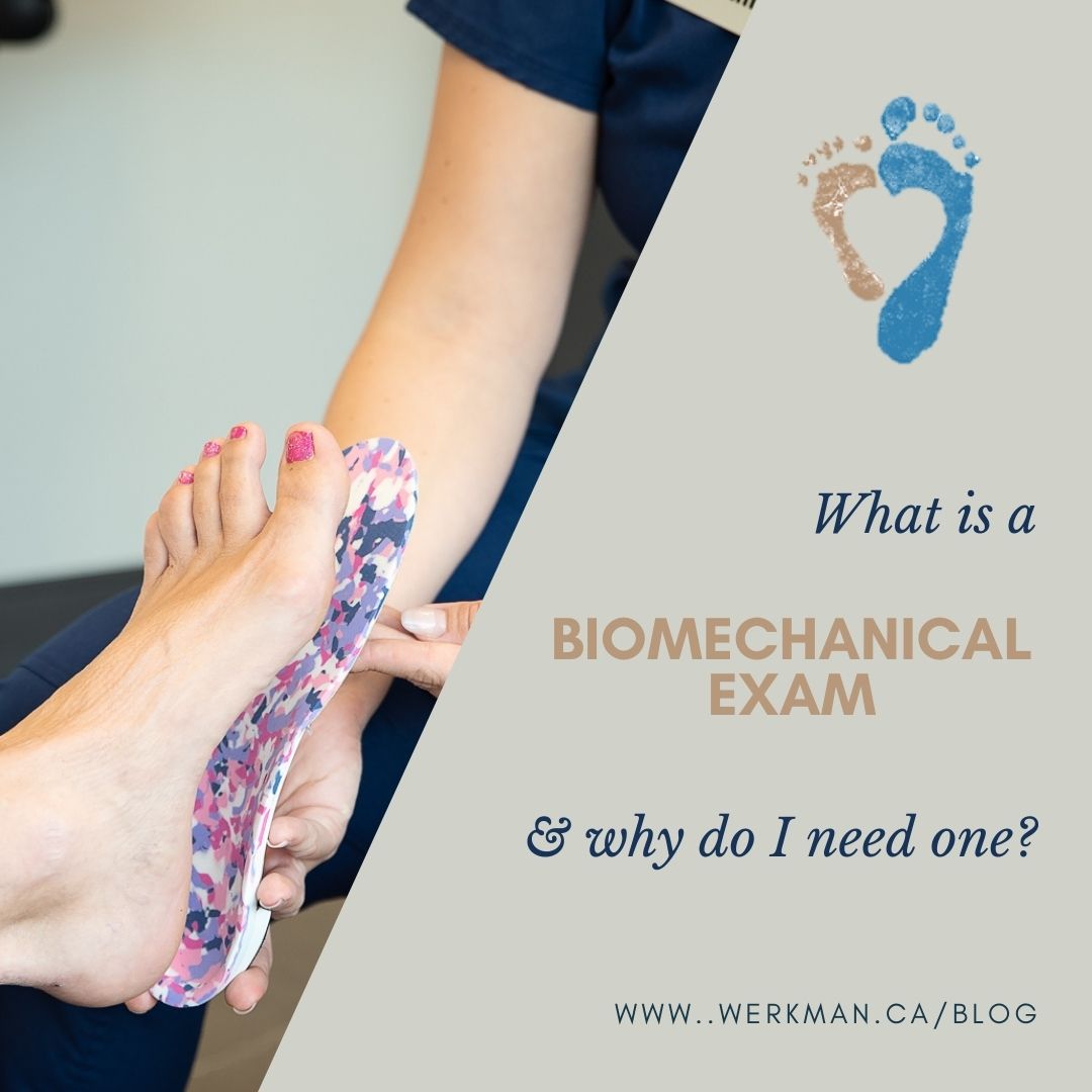 Supination (Foot Biomechanics) Explained - Types, Causes & Treatment