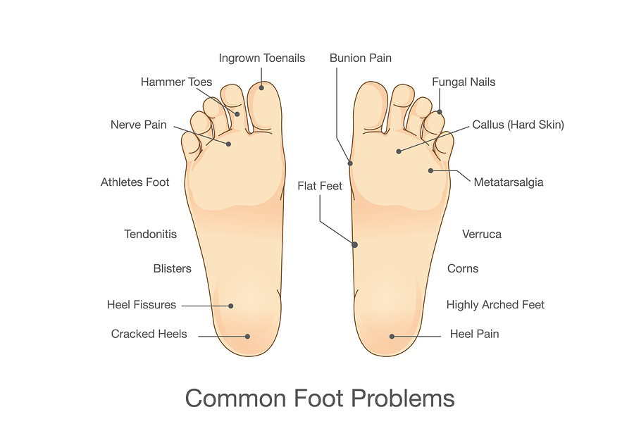 chart of common foot problems
