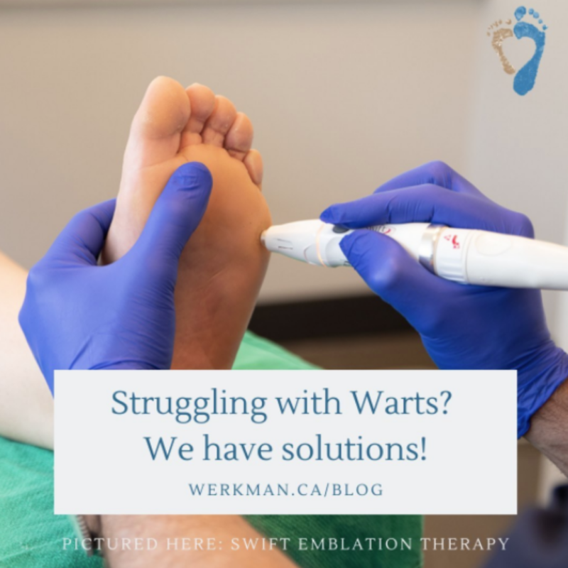 Excision & Curettage of Plantar Warts Werkman, Boven & Associates