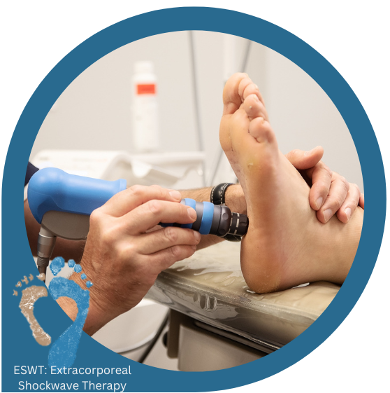 eswt: shockwave therapy
