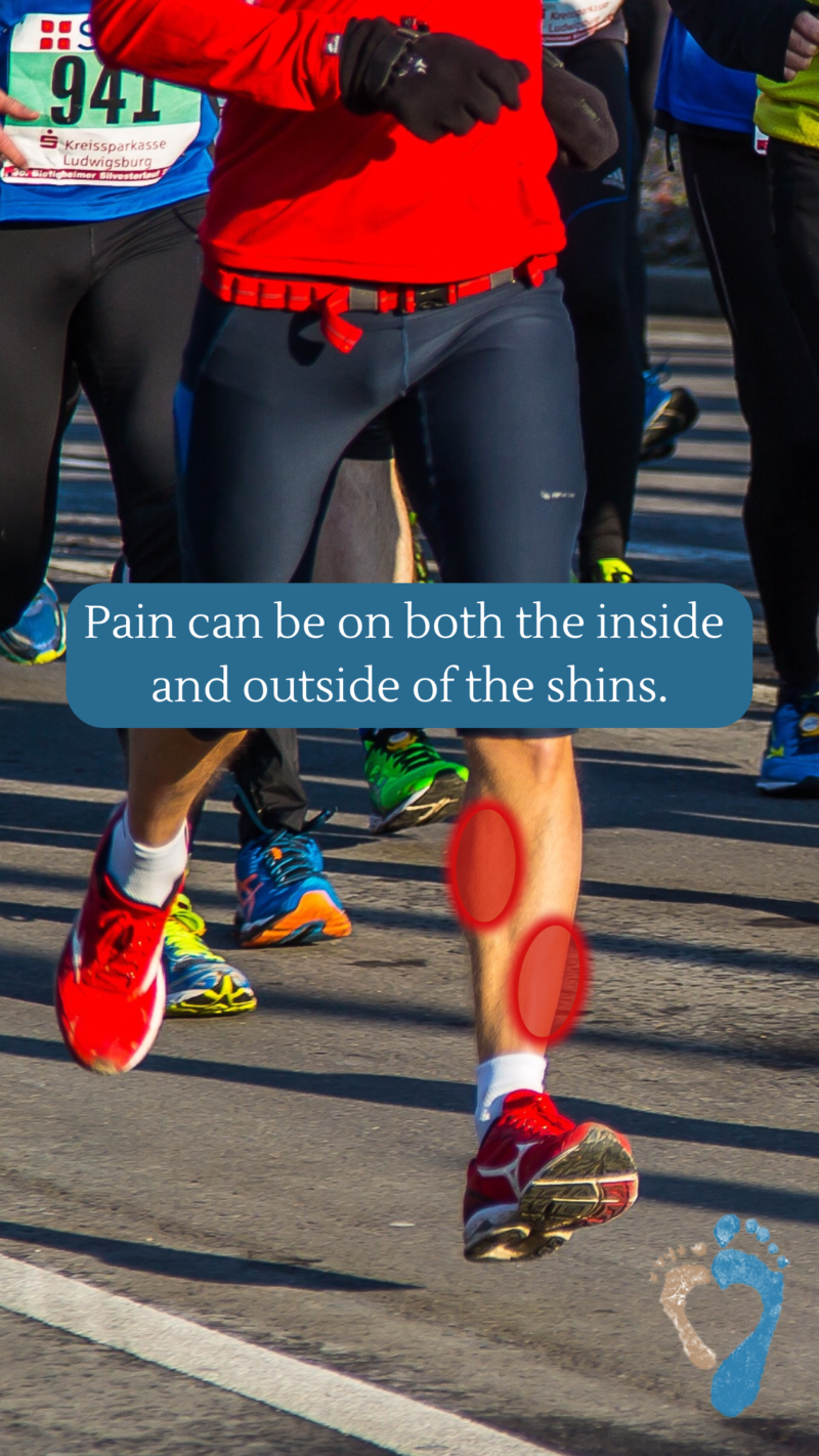 shin-pain-that-is-not-caused-by-shin-splints-causes-and-treatment