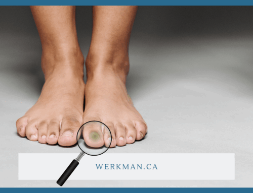 Fungal Nails? Here’s What You Need to Know