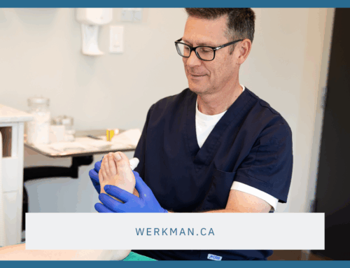 Preventing Foot Ulcers Before They Start