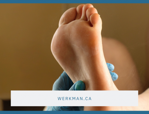 Is It a Corn, Wart, or Callus?