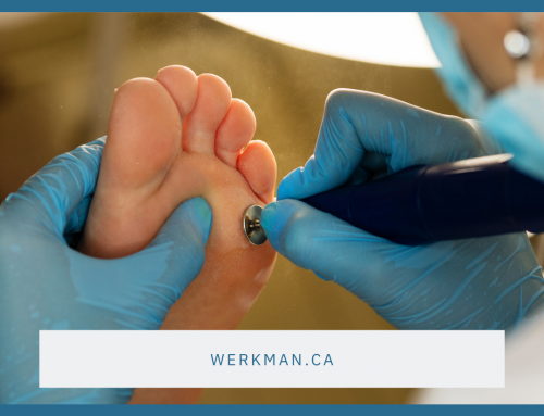 Stop Ignoring That Callus