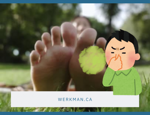 Sweaty Feet?